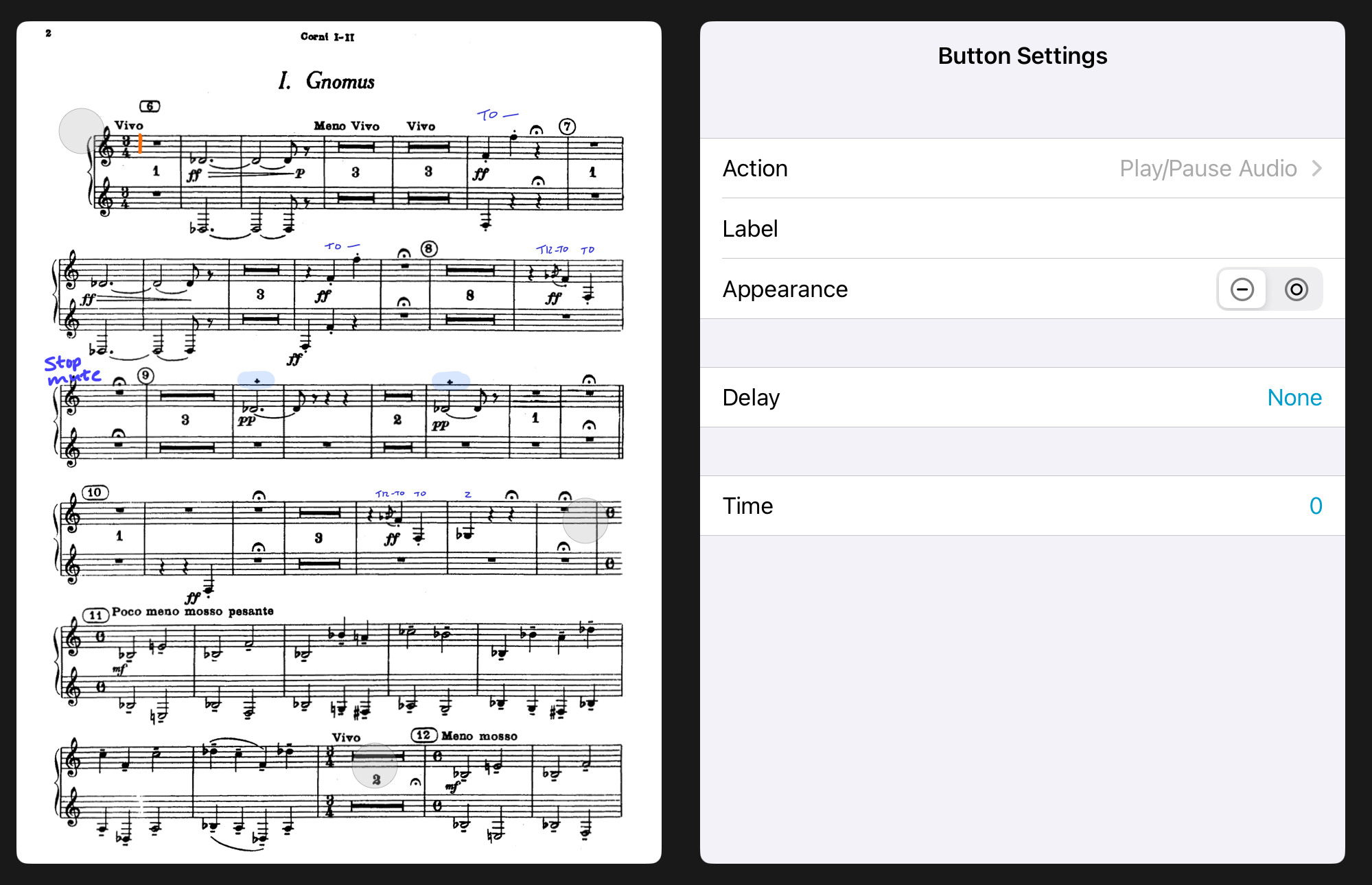 adding a button